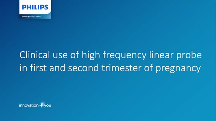 Doctor Tomasz Jachymski Clinical use of high frequency linear probe in first and second trimester of pregnancy tutorial thumbnail