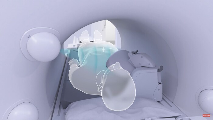 Video posted to YouTube of Philips MR SmartWorkflow in action