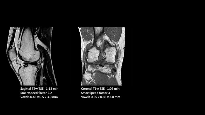 Knee image two