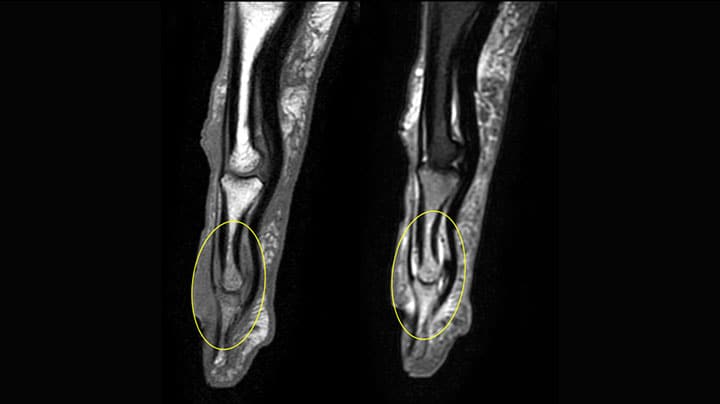 finger MRI