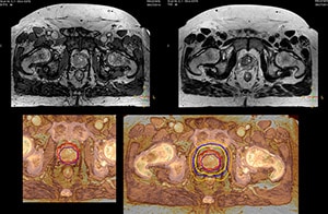 magnetic resonance thumbnail