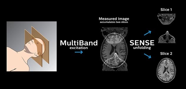 MultiBand SENSE principle