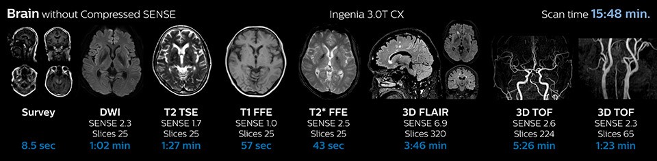 Brain without Compressed SENSE