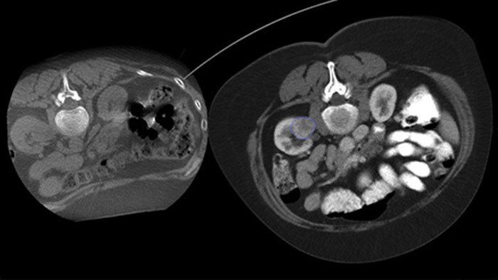 CBCT