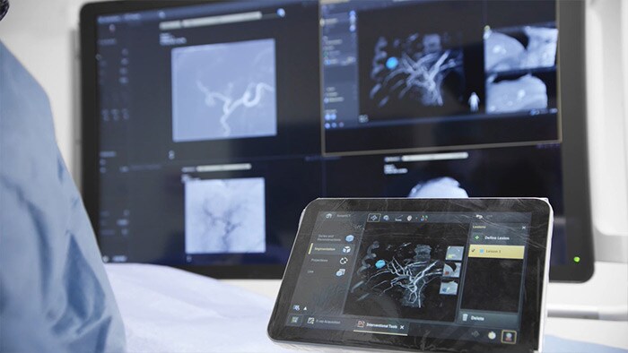 SmartCT 3D imaging