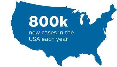 New cases in the USA each year