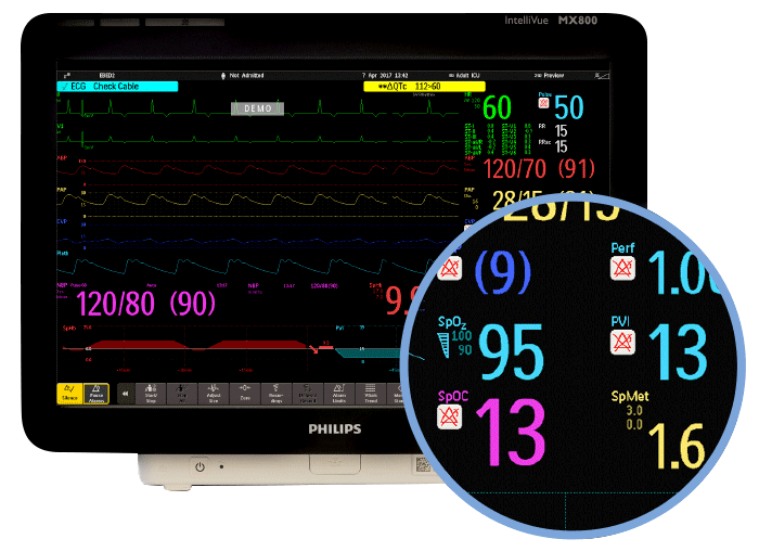 Masimo rainbow SET parameters