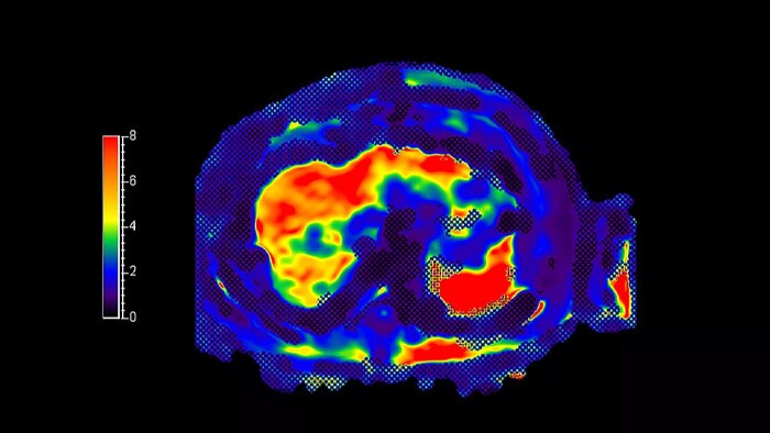 MR Elastography Extension