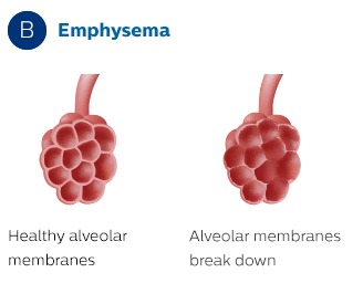 De alveolære membraner