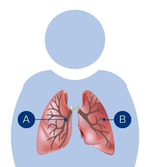 Tværsnit af lungerne