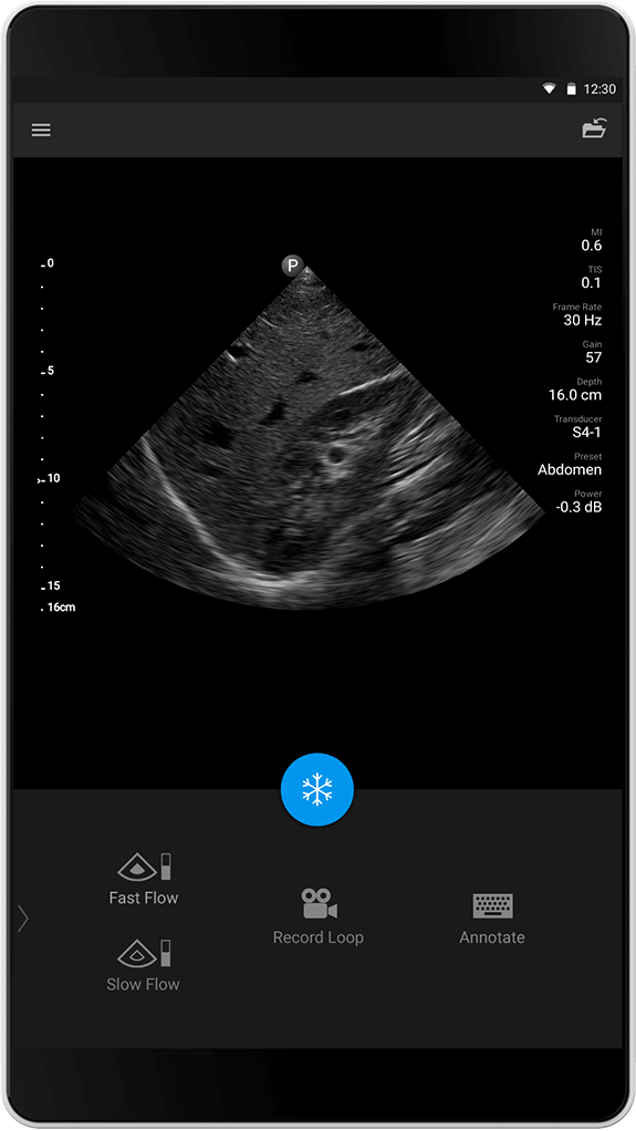 Undersøgelse af abdomen S4-1
