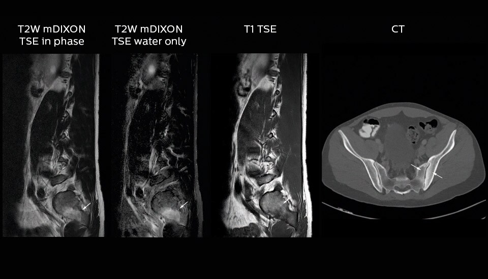 meander case image